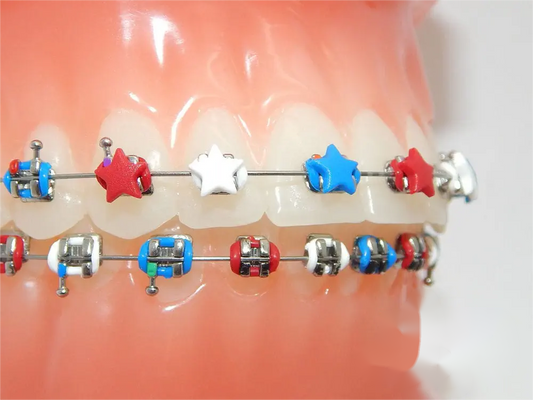 Fun Braces Ligature Ties