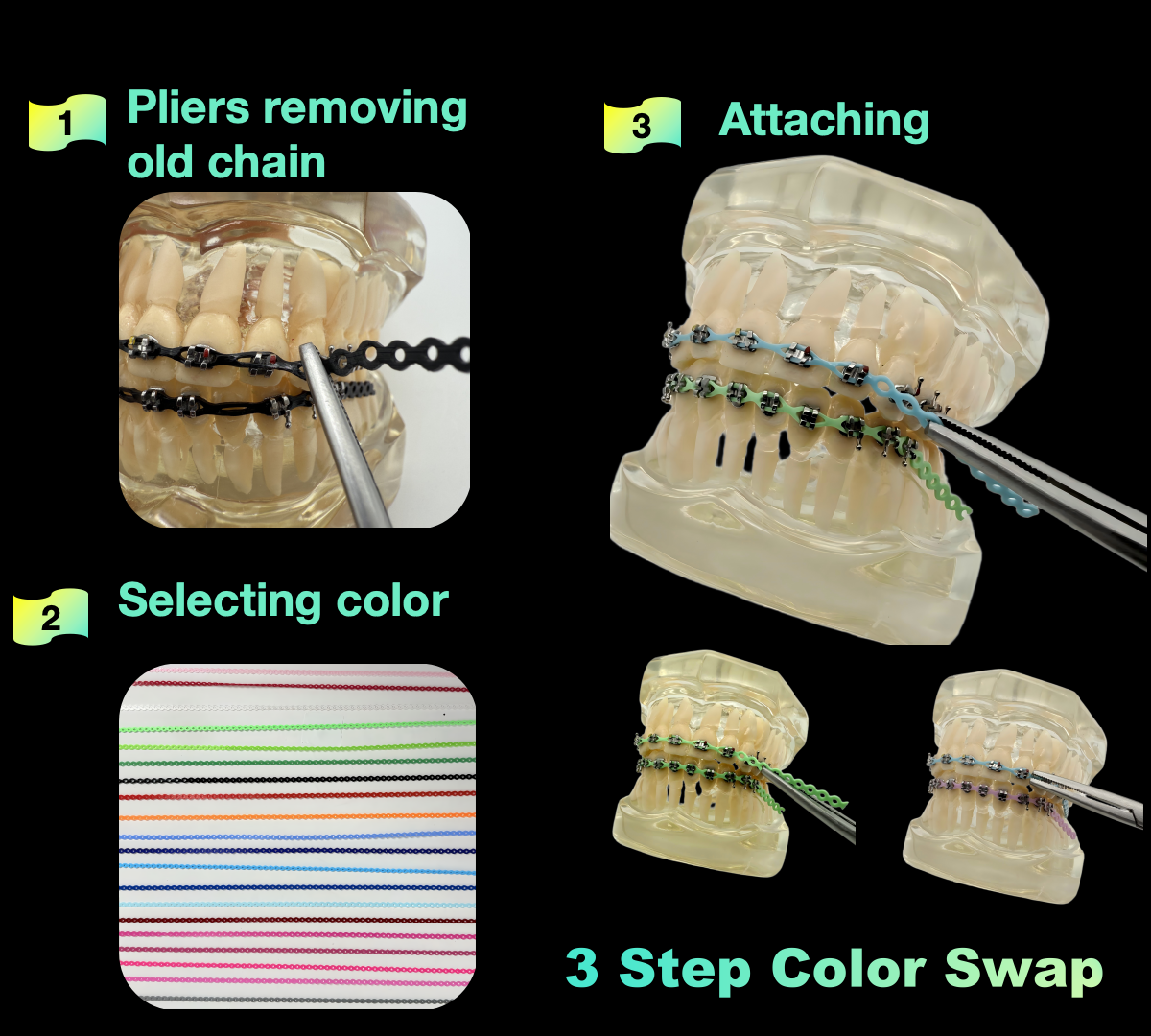 DIY Braces Power Chain Kit