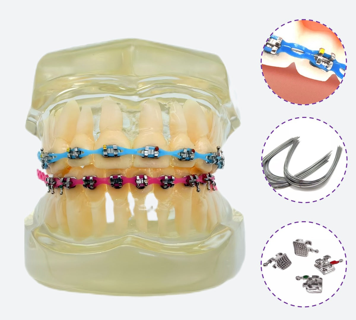 Braces Kit with Power Chain 20 Colors