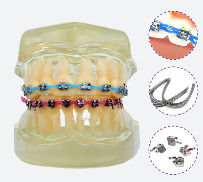 Braces Kit with Power Chain 20 Colors