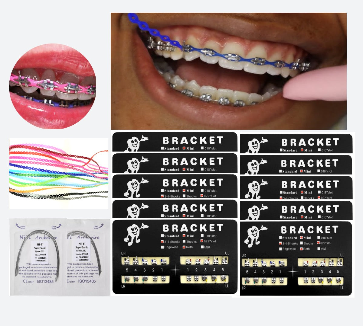 Braces Kit with Power Chain 20 Colors
