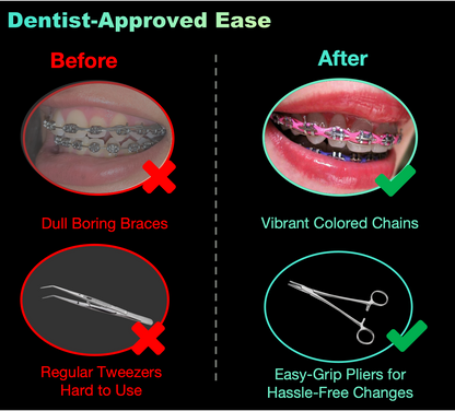 DIY Braces Power Chain Kit