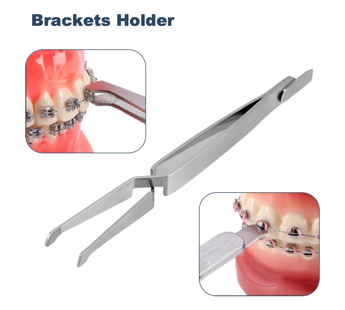 Braces DIY Tool Kit
