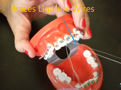 Braces Ligature Wire