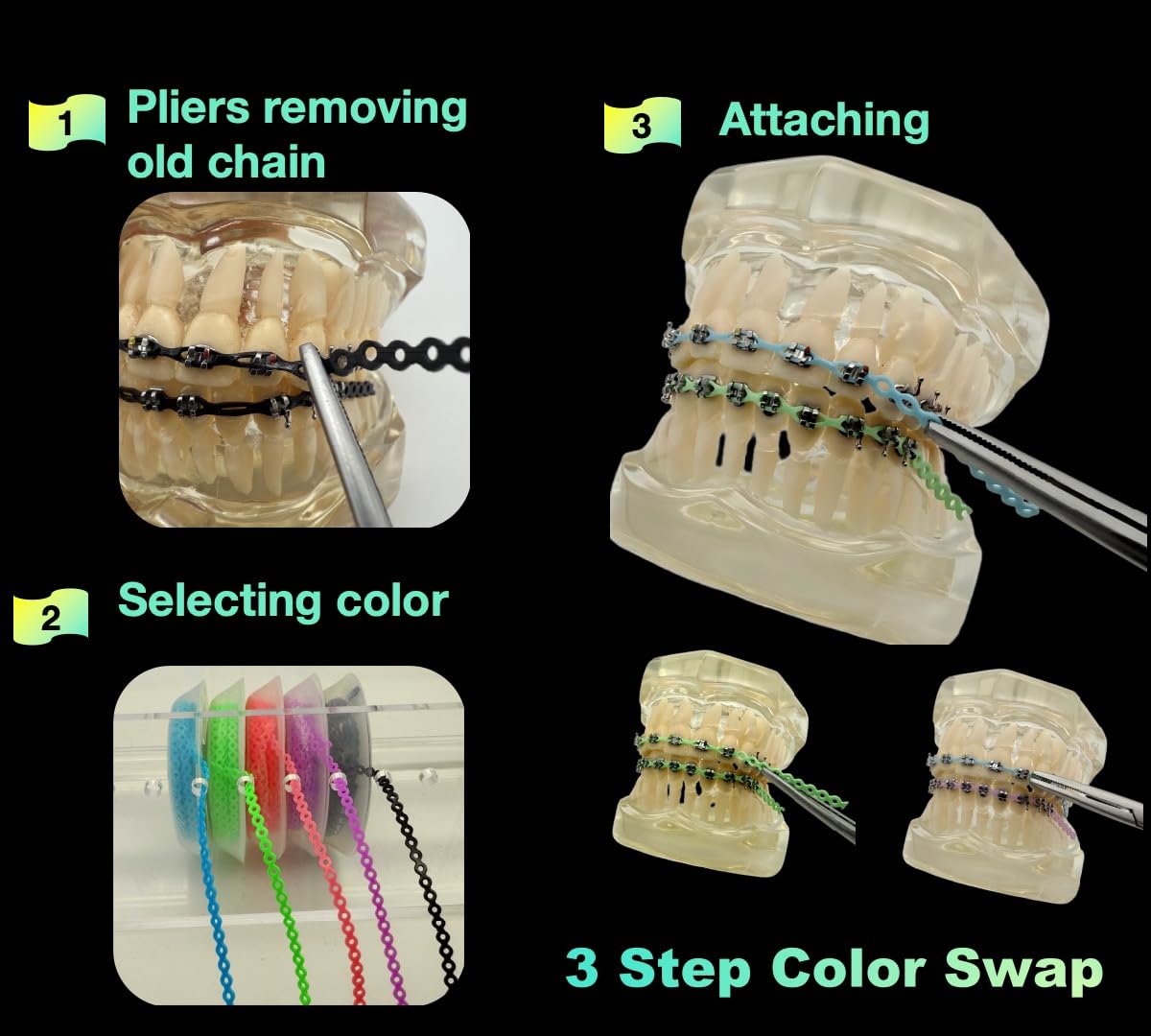 Braces Power Chain  5 Colors