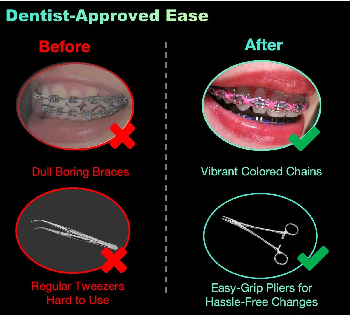 Braces Power Chain  5 Colors