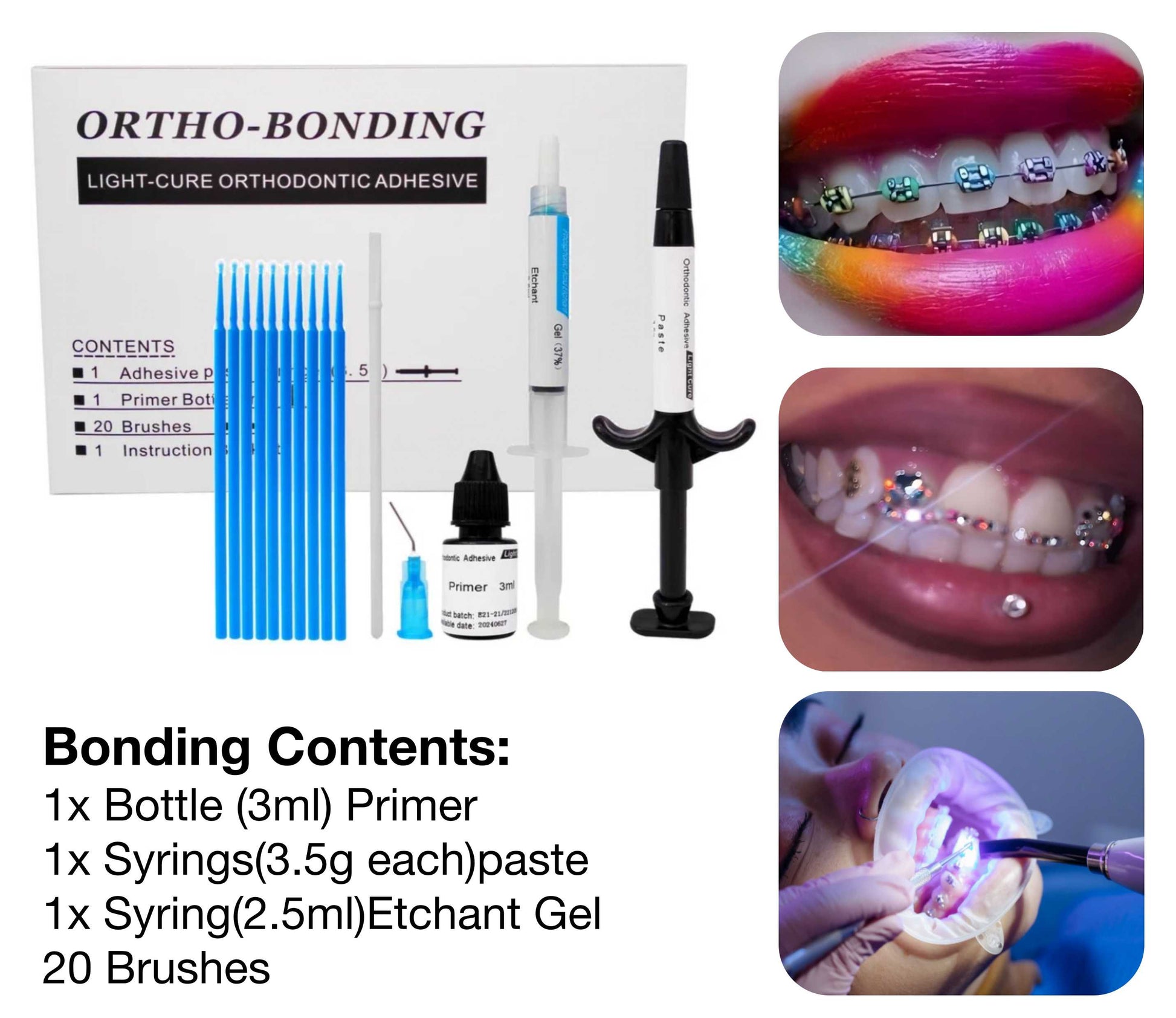 Adhesive paste syringe, primer bottle and application brushes for DIY braces installation
