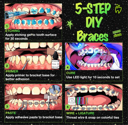 5 step guide for DIY fashion braces installation showing clean, place, thread, color, and cure process on dental model