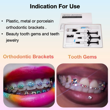 Braces Bonding Teeth Gems Glue