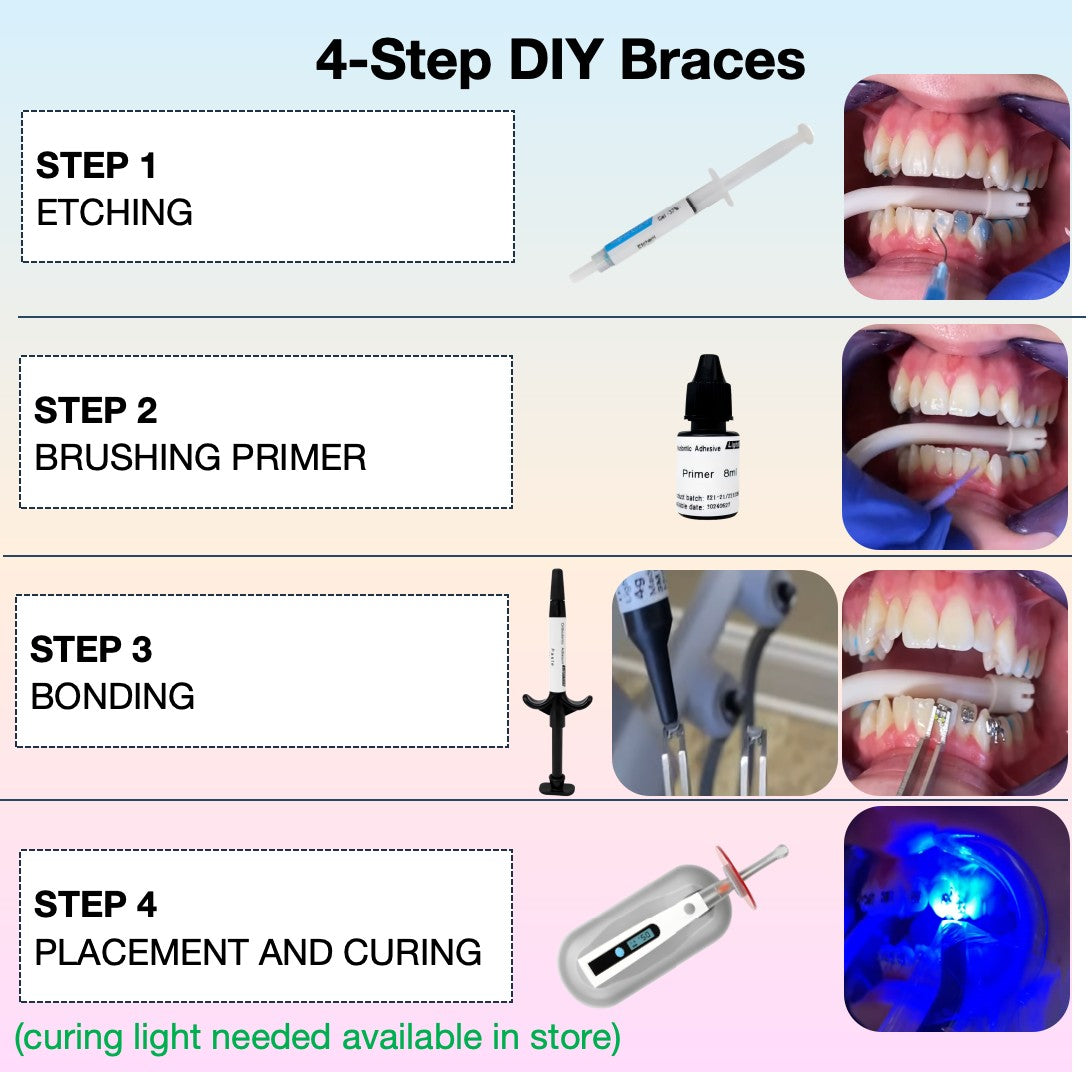 Braces Bonding Teeth Gems Glue