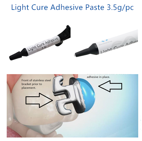 Close-up of precise dental bracket positioning with Sino Dental light-cure glue adhesive before curing